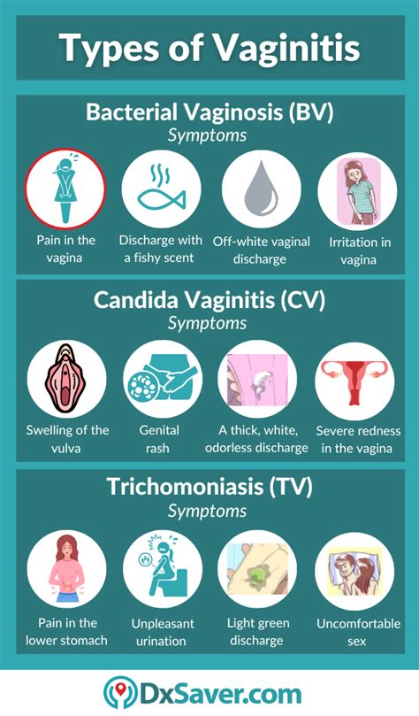 Vaginitis Test: Symptoms, Causes, Vaginal Health, and Vaginitis Testing Cost – DxSaver.com