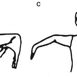 Beighton scoring system measures joint hypermobility on a 9-point... | Download Scientific Diagram