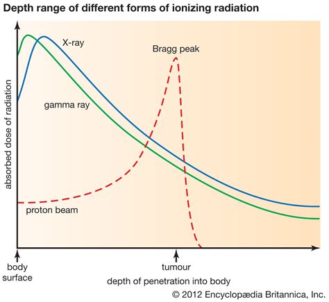 Radiation therapy | Definition, Types, & Side Effects | Britannica