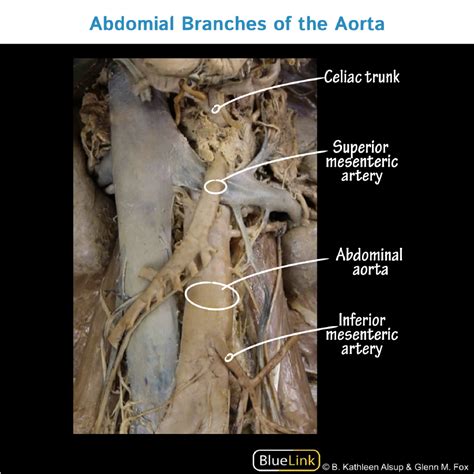 Gross Anatomy Glossary: Arteries - Superior & Inferior Mesenteric ...