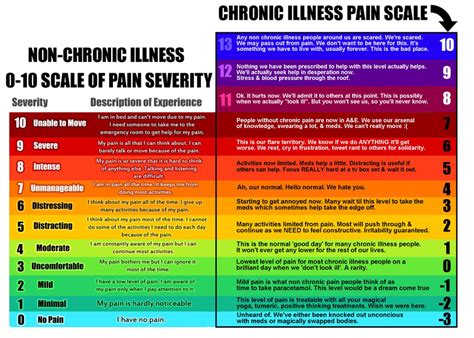 Pain Scale for chronic illness : r/Fibromyalgia