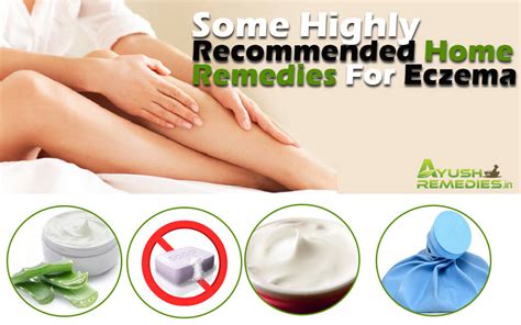 6 Home Remedies For Eczema, Highly Recommended Natural Treatments