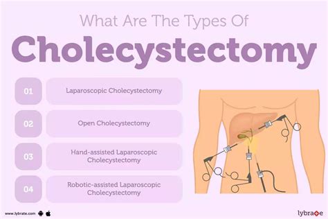 Open Cholecystectomy: Causes, Symptoms, Treatment and Cost