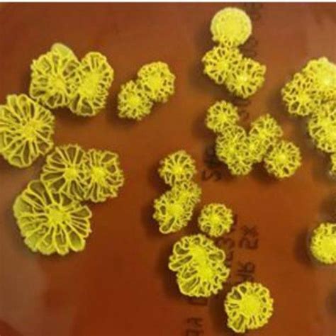 Microbiology Dr.Soleimani on Instagram: “Kocuria rhizophila is a soil dwelling #Gram positive # ...