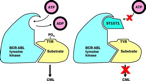 STI571: an inhibitor of the BCR-ABL tyrosine kinase for the treatment of chronic myelogenous ...