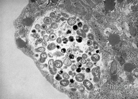 Chlamydia Bacteria In A Lung Cell #2 Photograph by Dr Kari Lounatmaa/science Photo Library - Pixels