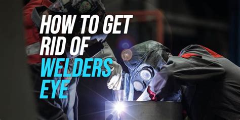 How to Get Rid of Welder’s Eye - WeldingWatch