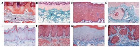 MMP-1/2 and TIMP-1/2 expression levels, and the levels of collagenous ...