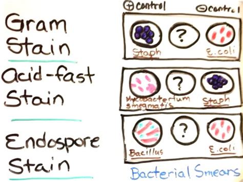 microbiology - Are acid-fast bacteria Gram-positive or Gram-negative? - Biology Stack Exchange