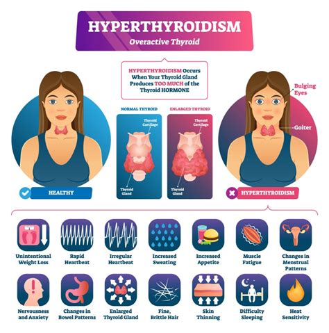 The vital importance of thyroid health. - St. Clair Health