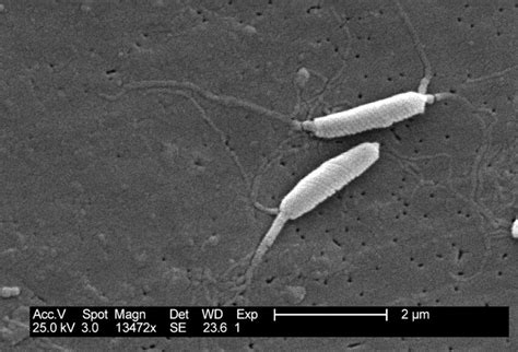 Free picture: flexispira rappini, bacteria, closely, related, helicobacter