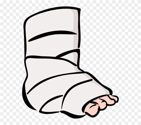 Free Broken Ankle Cliparts, Download Free Broken Ankle Cliparts png ...