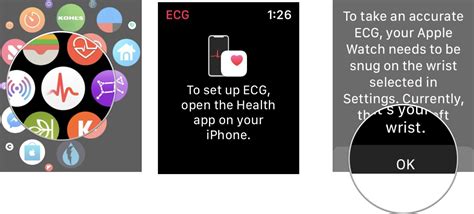 ECG Apple Watch App: The Ultimate Guide | iMore