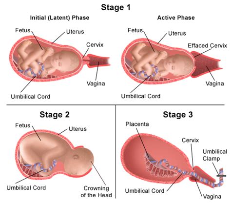 MSTC Paramedic Program / Stages of Labor