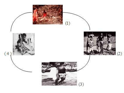 Stages of Kuru Disease. (Source: Google) | Download Scientific Diagram