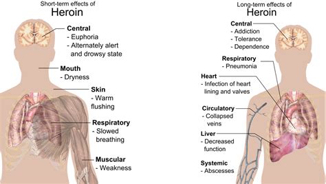 Demi Lovato Hospitalised: Here's Everything You Need To Know About Heroin Overdose | 🍏 LatestLY