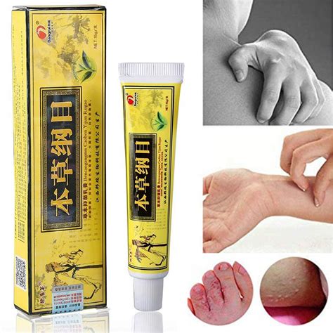 Buy High Quality Chinese al Eczema, Psoriasis Creams Dermatitis and ...