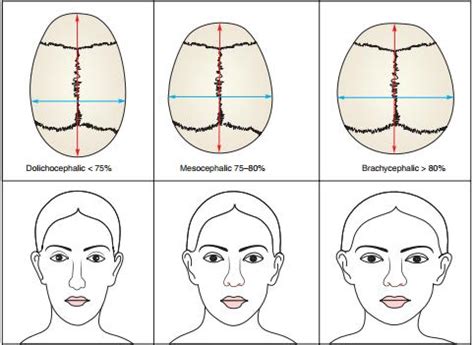 Cephalic index – Ace Achievers