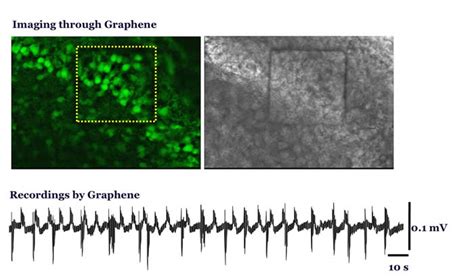 Neural Interface Technology – Litt Lab