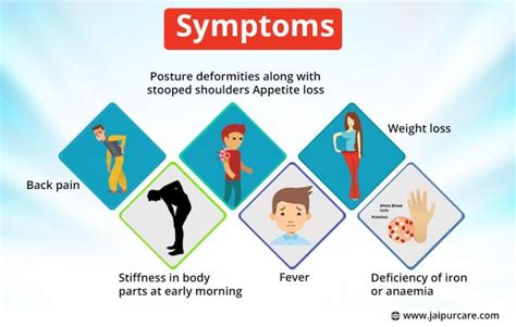 Ankylosing Spondylitis Treatment and Diagnosis at JaipurCare