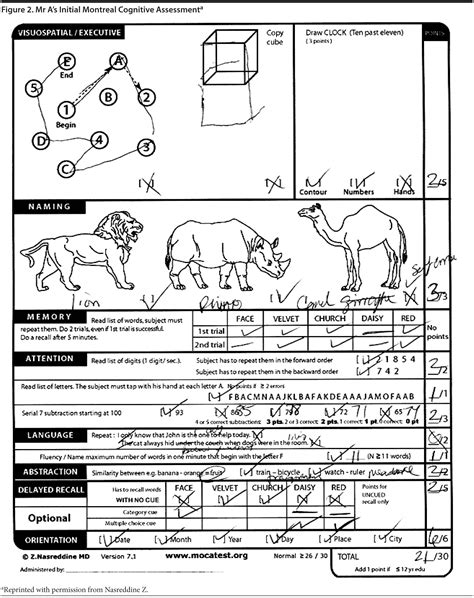 Quotes about Cognitive test (23 quotes)