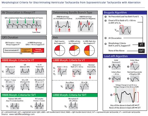 Wide QRS Tachycardia - SVT or VT ? - Manual of Medicine