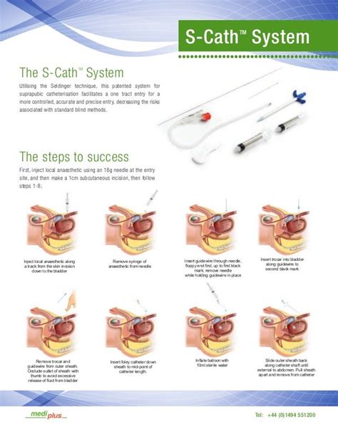 Medi-Plus S-Cath