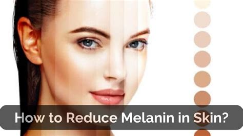 How to Reduce Melanin in Skin?