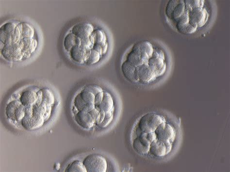 New IVF Discovery: Embryo Abnormalities Can be Caught Earlier Than Ever Before