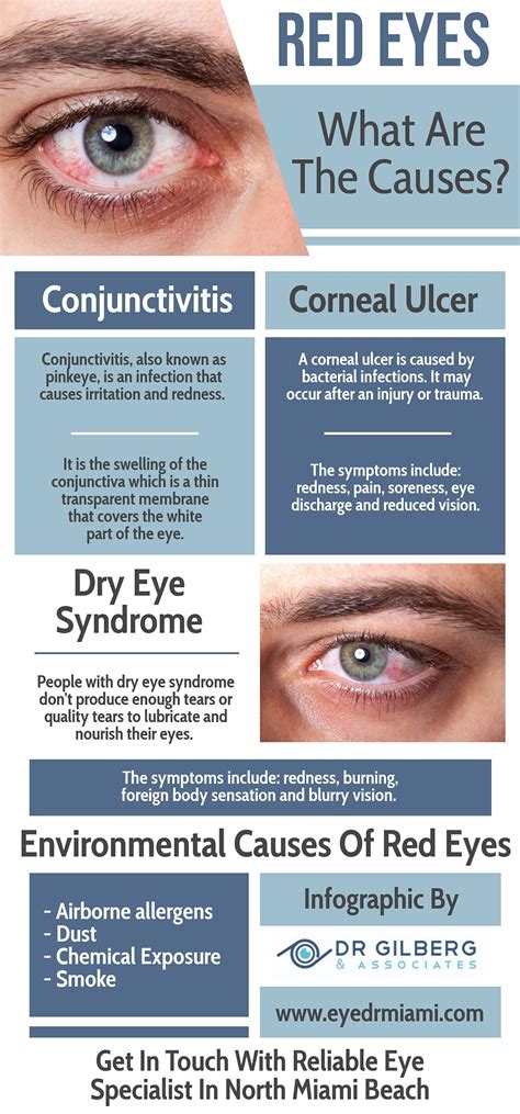 Red Eyes - What are the causes?