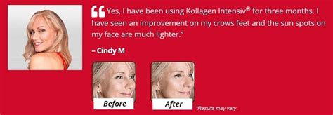 Kollagen Intensiv Before and After – Does It Work, User Reviews!