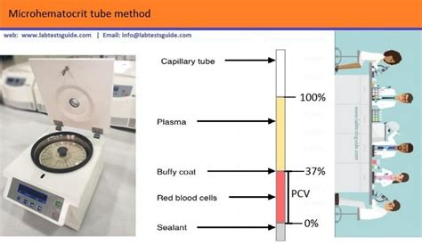 HCT Test Procedure - Lab Tests Guide