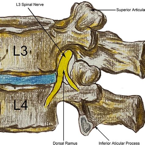 The course of the medial branch of dorsal ramus from the lumbar spinal ...