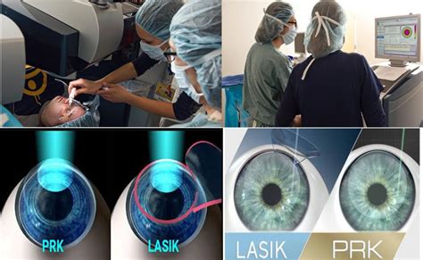 PRK Vs LASIK | Public Health