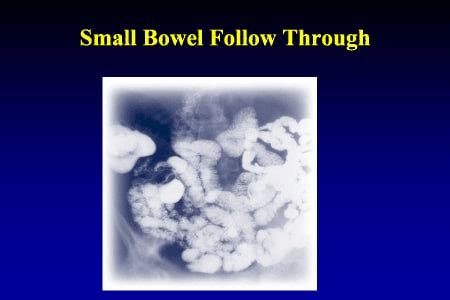 Biologic Therapies for Inflammatory Bowel Disease: Strategies for...