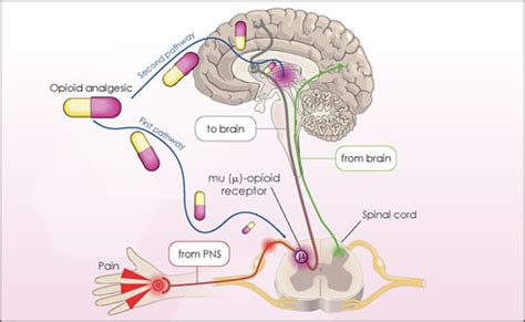 Can Using Narcotic Medications Make The Pain Worse? – MyPain.ca