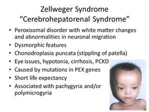 Zellweger Syndrome - Physiopedia