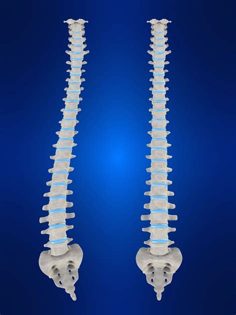 Adult Degenerative Scoliosis | Symptoms and Treatment