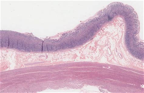 Pyloric Sphincter Histology