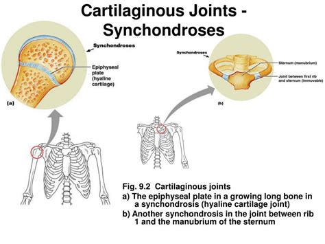 PPT - Joints Bone Connections PowerPoint Presentation - ID:176707