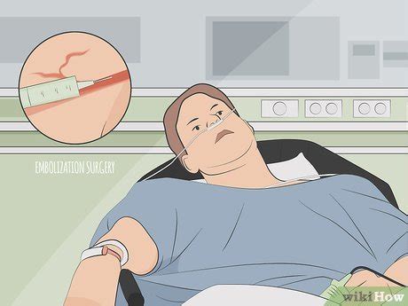 How to Treat Internal Bleeding: 13 Steps (with Pictures) - wikiHow