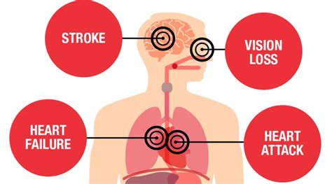 35 Surprising Facts About High Blood Pressure You Need to Know | Healing Heart Disease Naturally ...