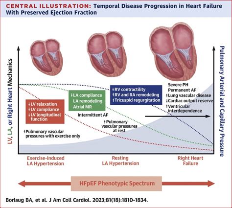 Heart Failure With Preserved Ejection Fraction: JACC Scientific ...