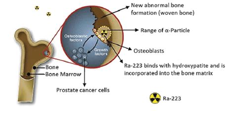 Mechanism of action of radium-223 (5). | Download Scientific Diagram