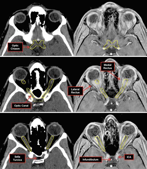 Cranial Nerves | SpringerLink