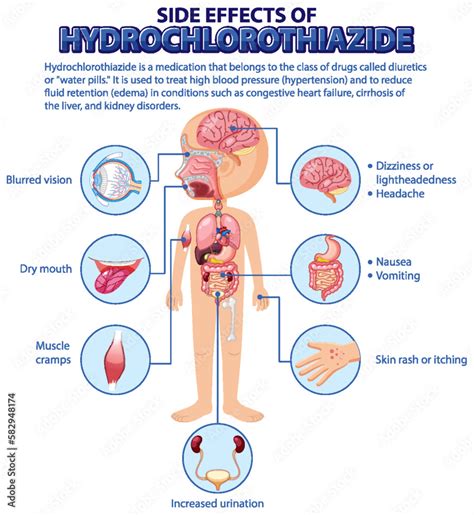 Human anatomy diagram cartoon style of hydrochlorothiazide side effects Stock Vector | Adobe Stock