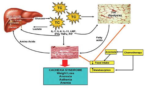 graviolateam finland: Cancer cachexia, mechanism and treatment ...