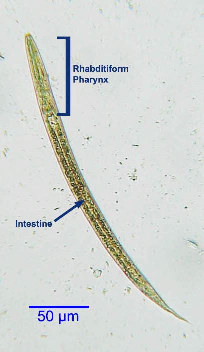 Strongyloides stercoralis - Learn About Parasites - Western College of ...