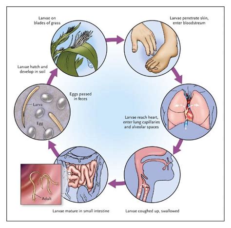 [DIAGRAM] Ancylostoma Duodenale Diagram - MYDIAGRAM.ONLINE