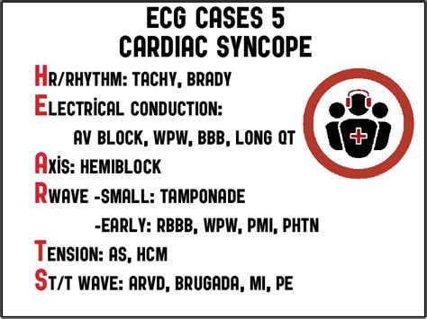 Cardiac syncope ECG Interpretation | ECG cases | EM Cases